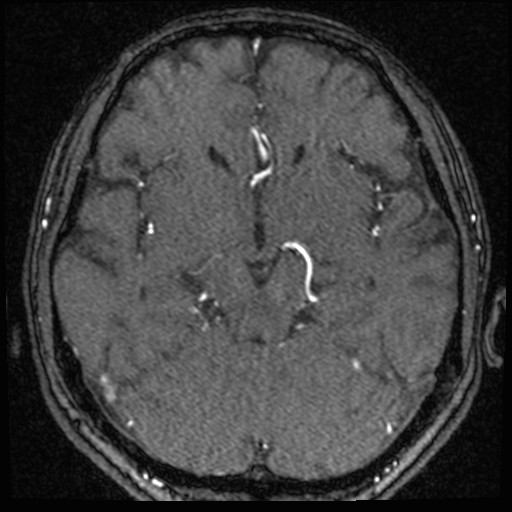 Click on the Serie image to view the images of VILLANUEVA, WILLIAM A.